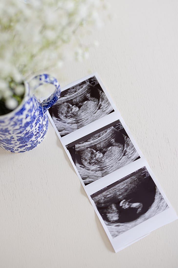 baby ultrasound waving